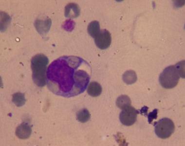 online konzultációk Hogyan kezelik a genitális mycoplasmákkal kapcsolatos betegségeket
